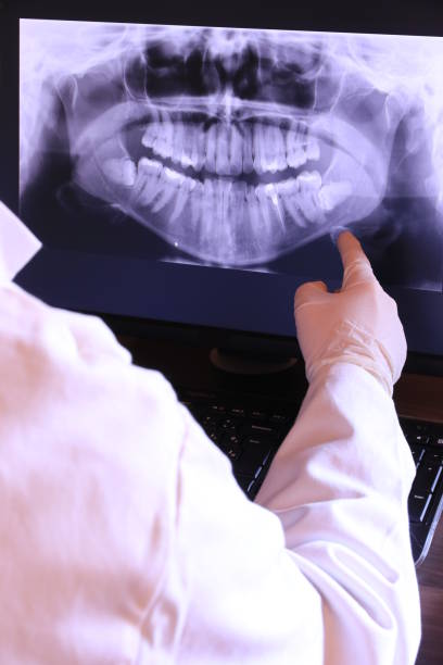 Best Emergency Root Canal Treatment in Tobaccoville, NC